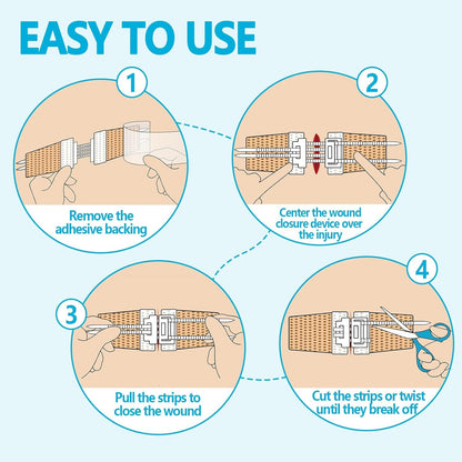 Wound Closure Device