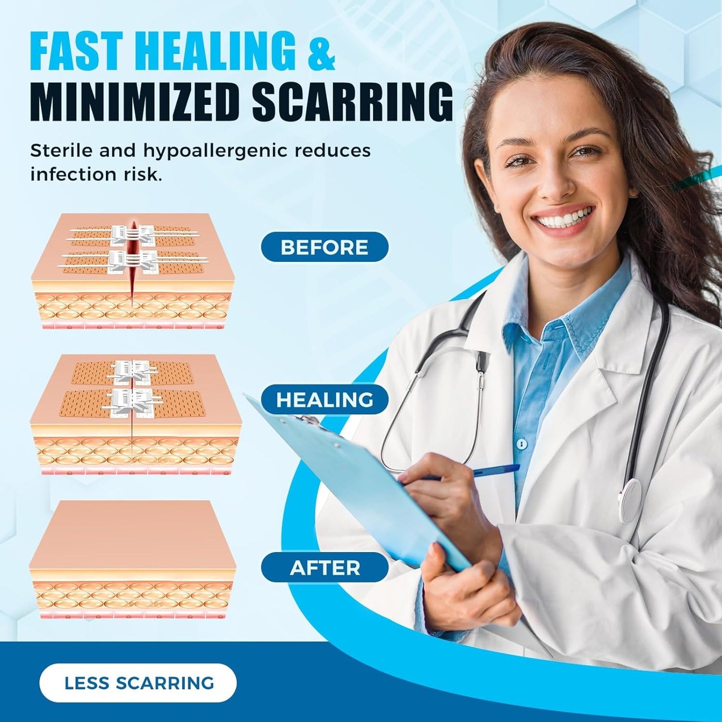 Wound Closure Device