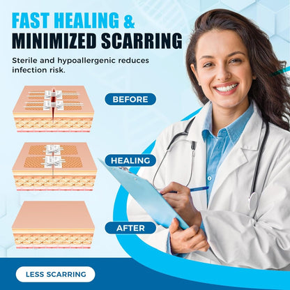 Wound Closure Device